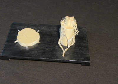 Modello del midollo spinale, con sezione.