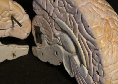 modello del cervello (sezione longitudinale a livello della scissura centrale, particolari), 2