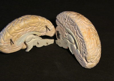 modello del cervello (sezione longitudinale a livello della scissura centrale),3