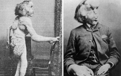 THE ELEPHANT MAN